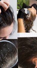 Load image into Gallery viewer, Detox Scalp Mask
